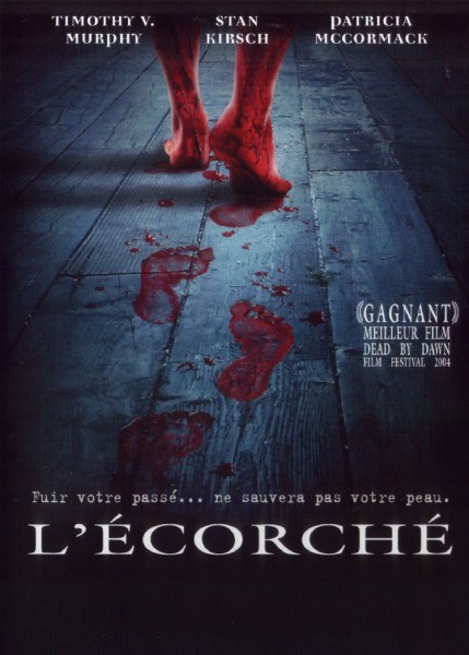 L'Écorché