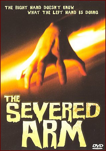 The Severed Arm