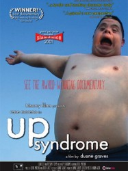 Up Syndrome